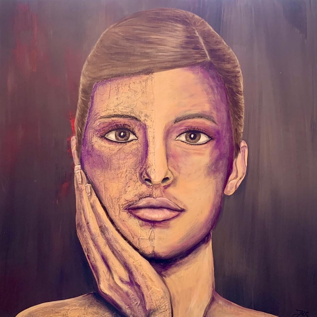 Psoriasis in der Kunst