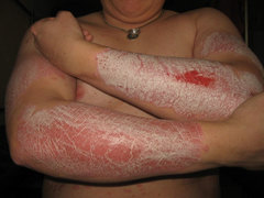 arme