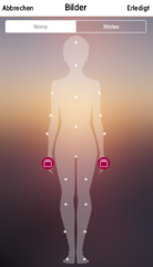My Psoriasis App