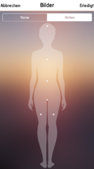 My Psoriasis App