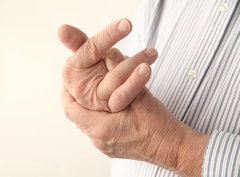 Psoriasis arthritis
