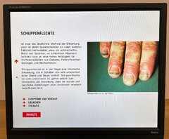 Schuppenflechte – Einführungstext