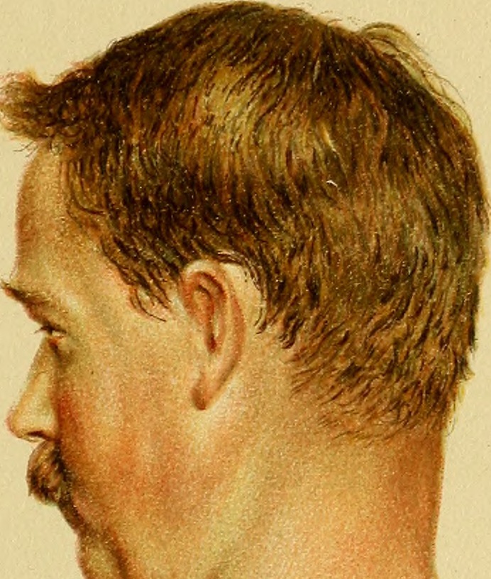 Ist die Teerbehandlung unmodern?