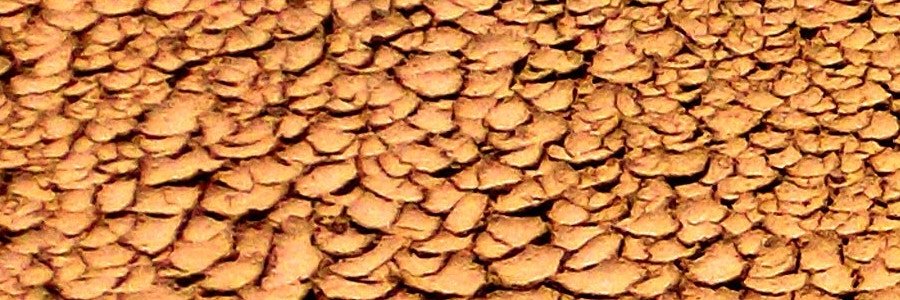 Seborrhoisches Ekzem oder Psoriasis?