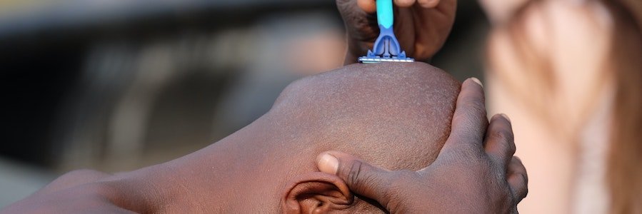 Haare ab, Schuppenflechte weg?