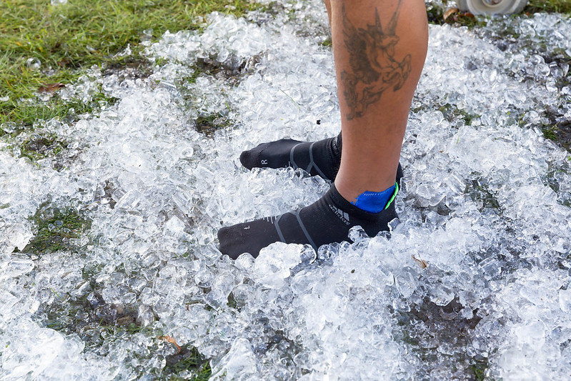 Psoriasis arthritis mit Enthesitis: Was wirkt am besten?