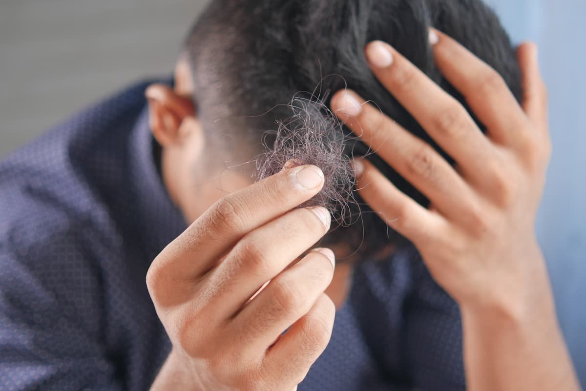 Haarausfall durch Schuppenflechte – was hilft?