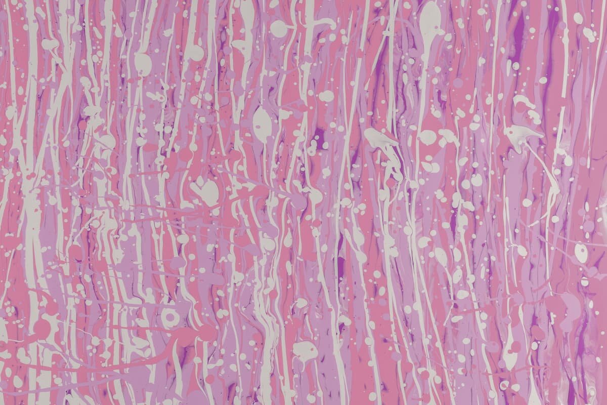 Psoriasis guttata: Was hilft Euch, wenn Ihr Schübe habt?