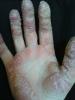 post-29187-0-38794800-1330122281_thumb.jpg