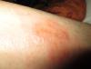 post-31577-0-19694400-1362087908_thumb.jpg