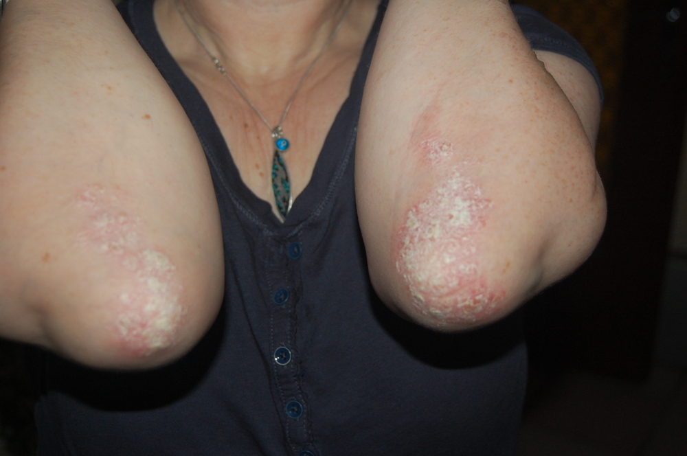 PSO auch 10.12.14.JPG