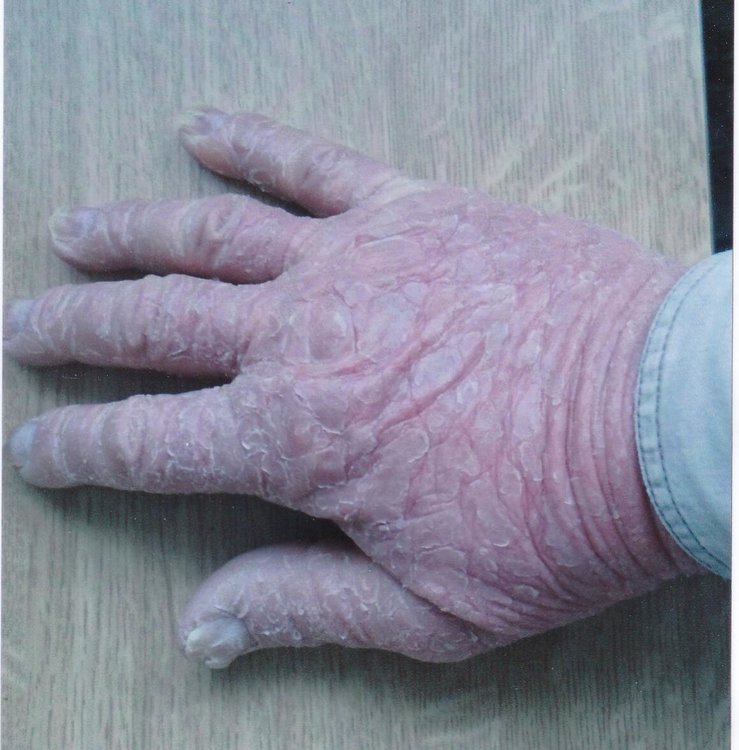 meine rechte Hand .jpg