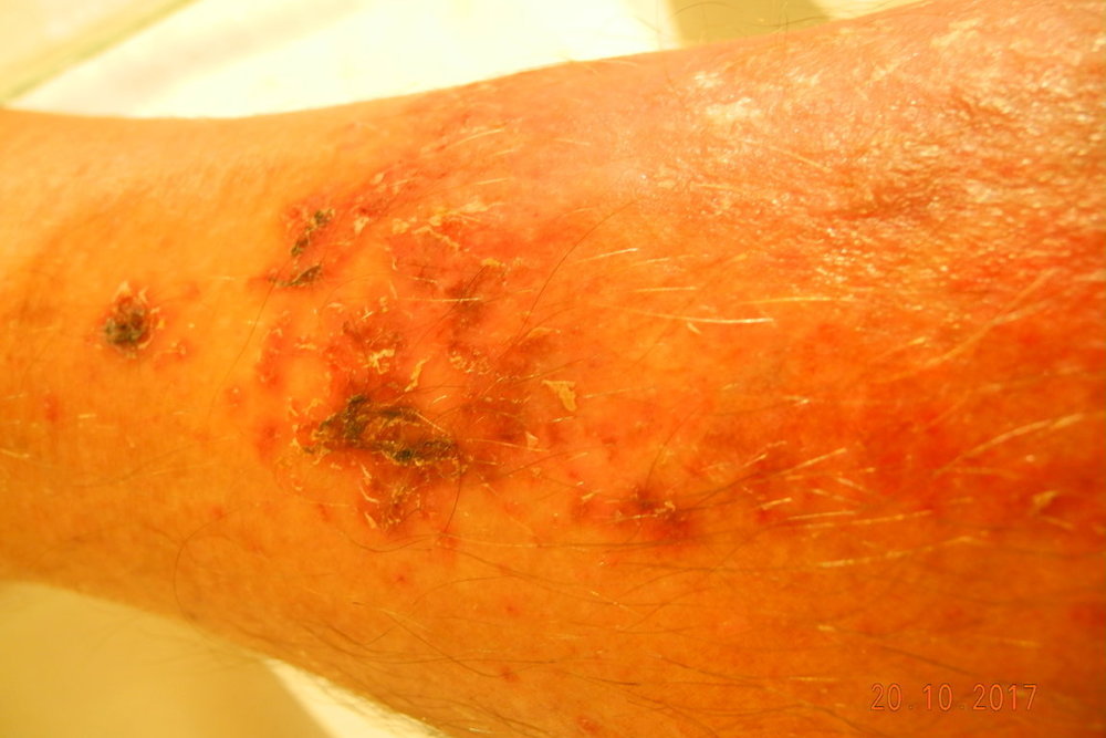 DSCN5098 (FILEminimizer).JPG