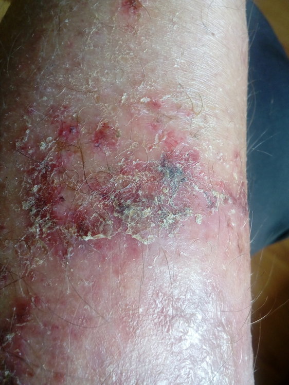 IMG_20171018_120257 (FILEminimizer).jpg