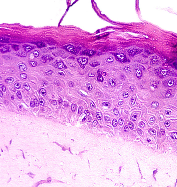 Gesunde-Epidermis.jpg