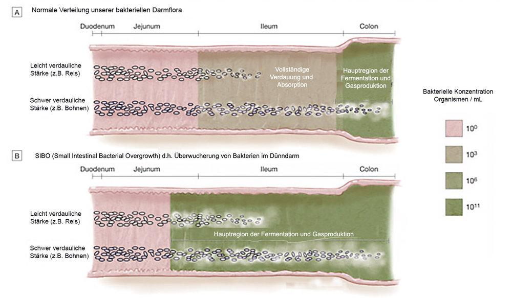 SIBO-Darmbereiche-2.thumb.jpg.e8f223ccab614608c46d623168819d27.jpg