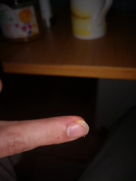 Ölfilm unter dem NAgel.jpg