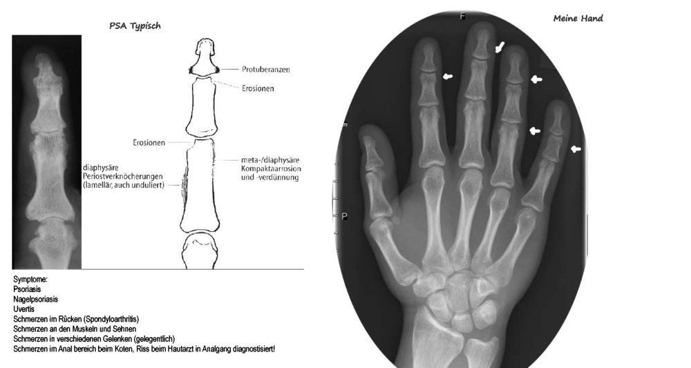NR 1 PSA Indizien.jpg