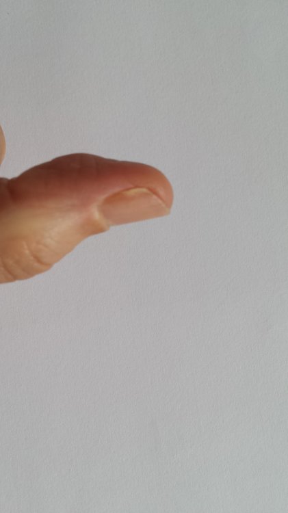 1. Zeichen_ Weissfärbung am Nagelrand.jpg