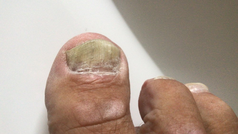 Vor der Behandlung0.jpg