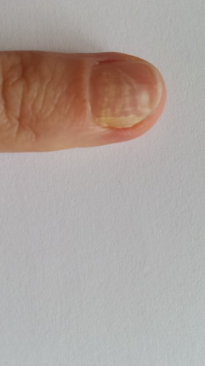 Ölflecken unter dem Nagel.jpg