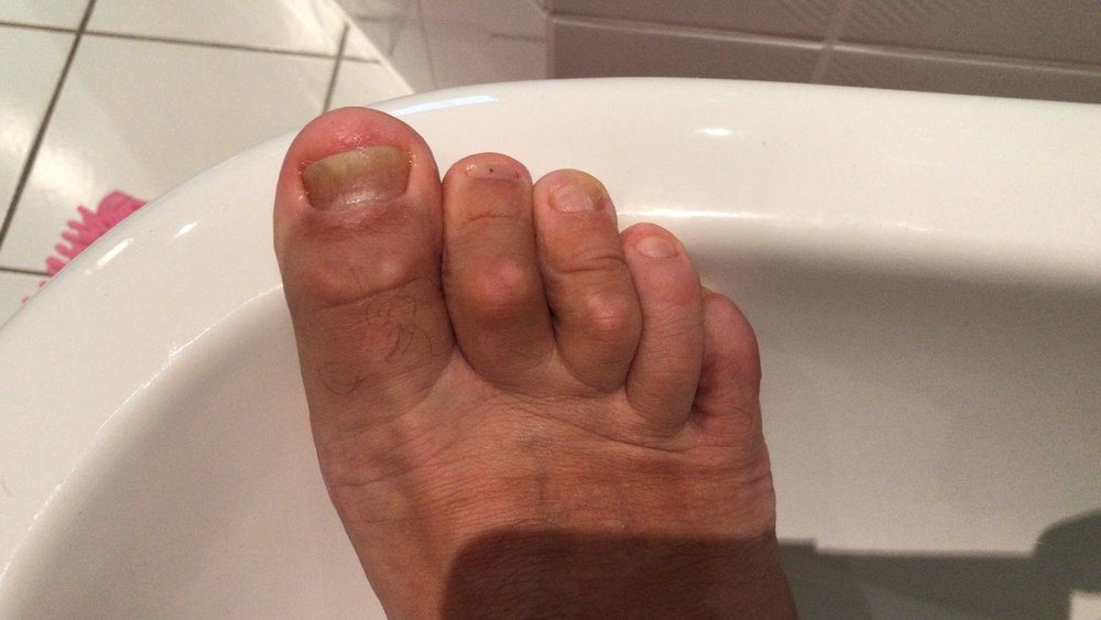 Nach der Behandlung rechts.jpg