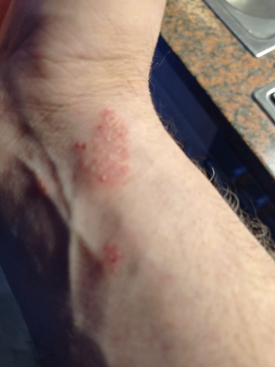 Vor Beginn mit Xyndet Shampoo.jpg