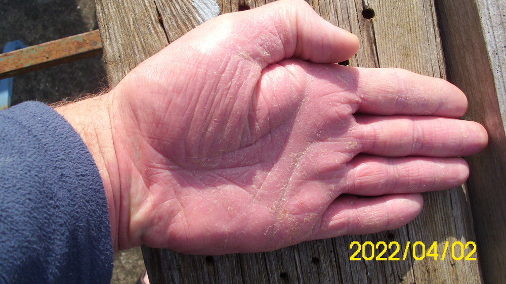 2022-04-02_Hand_Links.thumb.JPG.60be72bd180628e086b0b71dc1113175.JPG