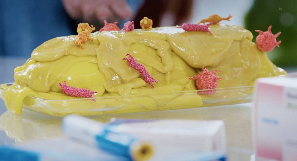 Überschüssiges Bauchfett bei Übergewicht