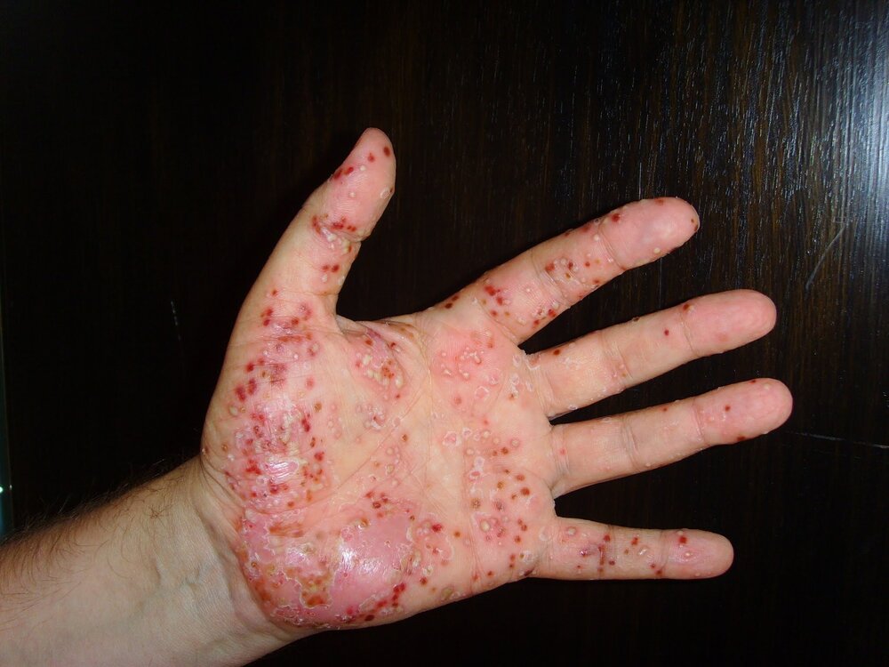 Bild 065_Original.jpeg