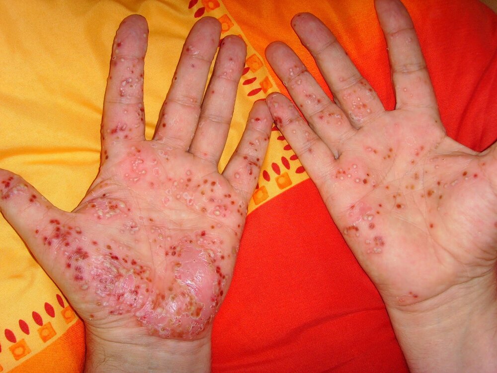 Bild 070_Original.jpeg